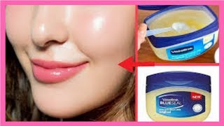 How to remove Blackheads from Lips [upl. by Les]