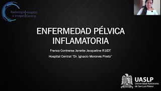 Enfermedad pelvica inflamatoria Dra Janette Jacqueline Franco Contreras [upl. by Norina635]