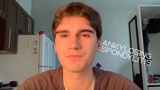 Living with Ankylosing Spondylitis  My Story  Motivation and Tips [upl. by Ihel]