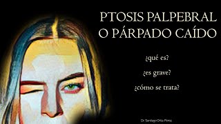 Ptosis Palpebral o Párpado Caído [upl. by Nivets]