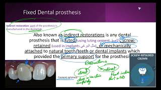 Introduction to Fixed Prosthodontics [upl. by Timmie]