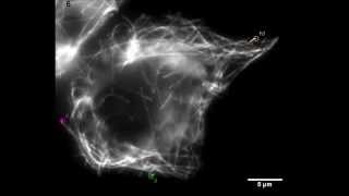 TOG Proteins Are Spatially Regulated by RacGSK3β to Control Interphase Microtubule Dynamics [upl. by Sorcim565]