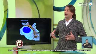 Red de salud  Hernia de disco  290715 [upl. by Tillman]