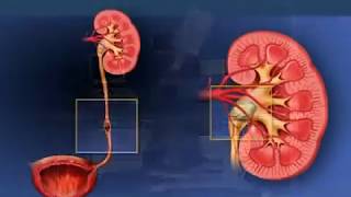 Litotripsia Extracorpórea por Ondas de Choque Urología Peruana Dr Luis Susaníbar [upl. by Ernie]