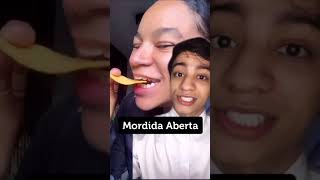 Mordida Aberta ELA NÃO CONSEGUE COMER [upl. by Elades]