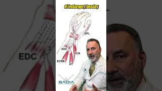 Join us tomorrow for live surgery Tuesday EIP to EPL tendon transfer [upl. by Lael]