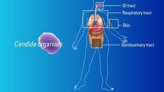 Sources of Candida Organisms [upl. by Baiel208]