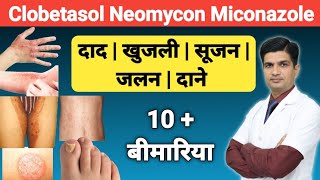 दाद खुजली को ठीक करने की क्रीम । Clobetasol Neomycin and Miconazole cream [upl. by Sokram295]