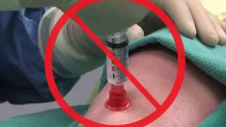 Insertion of an Intraosseous Needle in Adults [upl. by Clarke]