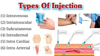 Types Of Injection and Their Site  Route of Injection  Injection Types [upl. by Yakcm822]