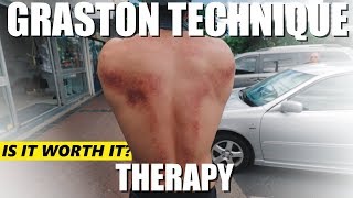 Graston Technique Muscle Scraping  MY EXPERIENCE [upl. by Gabor]