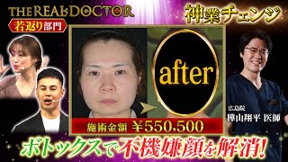 【切らない若返り】40代の不機嫌顔をスッキリと若々しい印象へと生まれ変わらせる広島の神業ドクター 湘南美容クリニック [upl. by Tjaden]