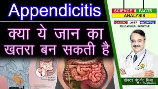 क्या ये जान का ख़तरा बन सकती है  APPENDICITIS FACTS [upl. by Noryb237]