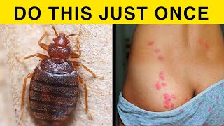 bed bugs  how to get rid of bed bugs  pest control  baking soda [upl. by Ploch]