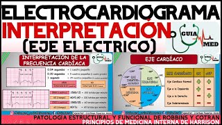 ELECTROCARDIOGRAMA INTERPRETACIÓN  GuiaMed [upl. by Midas]