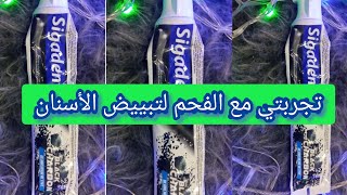 تجربتي مع الفحم لتبييضالأسنان dentifricesمعجونالاسنان [upl. by Missak]