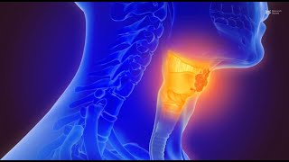 Mechanisms and prospects of HPVinduced oropharyngeal squamous cell carcinoma [upl. by Franck141]