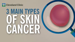 3 Types of Skin Cancer [upl. by Claudia]