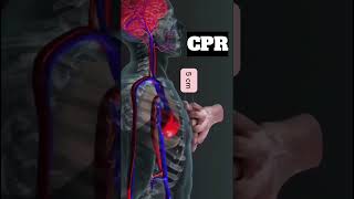 I Tried CPR On A Real Heart Attack Victim [upl. by Ltihcox360]