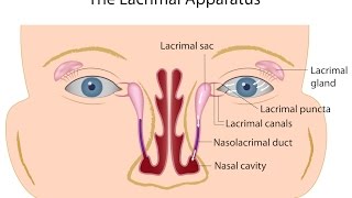 Nasolacrimal Duct Obstruction [upl. by Gonnella295]