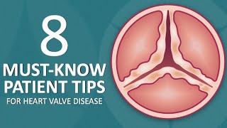 Patient Webinar 8 MustKnow Tips for Heart Valve Disease Patients [upl. by Kato]