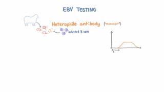 Epstein Barr Virus EBV Diagnosis and Testing [upl. by Gillian]