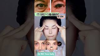 Eye Bags amp Tear Troughs are Gone  Eye Exercise facialyoga yoga faceyoga eyelift shorts [upl. by Atilrep203]