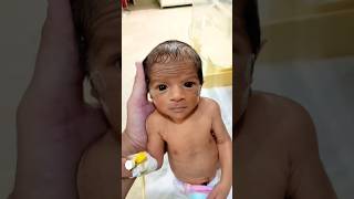 Amazing baby birth shortsviral viralvideo birth baby nicu [upl. by Asenab176]