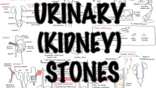 UrinaryKidney Stones  Overview signs and symptoms risk factors pathophysiology treatment [upl. by Cyprian235]