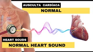 AUSCULTA CARDÍACA NORMAL  Normal Heart Sounds [upl. by Heilner]