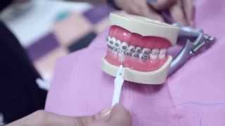 How to Floss and Brush Properly if You Have Braces [upl. by Mcdowell]