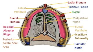 ANATOMICAL LANDMARKS OF MAXILLARY ARCH  MAXILLA  PROSTHODONTICS  DENTAL OCCLUSION [upl. by Twitt814]