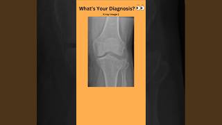 Whats Your Diagnosis 👀radiology radiography doctor nurse medicalstudent medicaltest [upl. by Sidman]