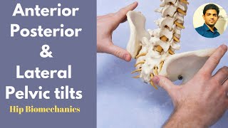 Anterior Pelvic tilt Posterior Pelvic tilt and Lateral Pelvic tilt Simplified [upl. by Atinahs]