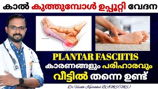 ഉപ്പൂറ്റി വേദന  Plantar Fasciitis Malayalam  പൂർണമായി മാറും  Dr Visakh Kadakkal [upl. by Harwilll]