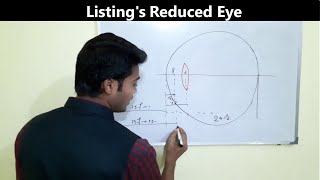 Listings reduced eye [upl. by Ramburt]