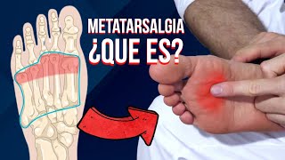 🦶🏻 Que es la METATARSALGIA causas sintomas y tratamiento [upl. by Nueovas363]