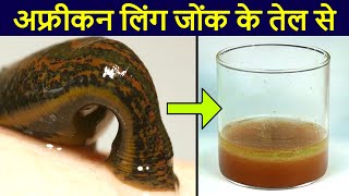 Benefits Of Leech Oil  जोंक का तेल बनाने की विधि [upl. by Fital774]