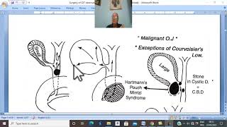 Biliary disorders in Arabic 13  Obstructive jaundice  part 1   by Dr Wahdan [upl. by Euh]