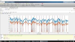 Pupillometry tutorial from A to Z 07 pupil data onsets filters range speed deviation [upl. by Orsay]