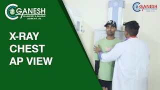 XRay Chest AP View  Test Purpose amp Complete Procedure at Ganesh Diagnostic [upl. by Htebarual572]