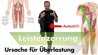 Leisten amp Adduktorenzerrungen  1 Der Hauptursachen [upl. by Celisse744]