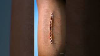 Wound healing process 3D video Shorts shorts shortsfeed funny [upl. by Court]