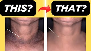 What Does This Skin Condition Mean Cause and Treatment of DARK DISCOLORATION ON YOUR NECK AND BODY [upl. by Assiroc]