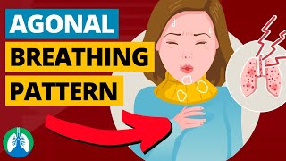 Agonal Breathing Medical Definition  Quick Explainer Video [upl. by Fredrika773]