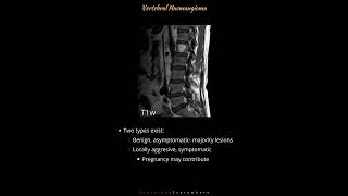 Spinal Hemangioma A to Z in 50 seconds  Radiology Tutorials  Radiology Everywhere  shorts [upl. by Ivy488]