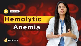 Hemolytic Anemia  Pathology Online Lectures  Medical Student Education  VLearning [upl. by Ashford843]