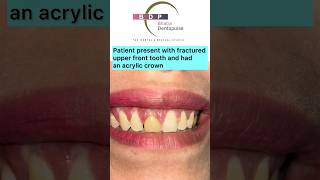 FRONT Teeth Smile Makeover with Zirconia Crown Dr Srishti Bhatia smilemakeover smile zirconia [upl. by Sidran]