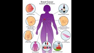 UCSF Radiology How MRI Image Guided Breast Biopsies Are Done [upl. by Anuahsar398]