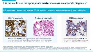 Systemic Mastocytosis Overview of Disease and Diagnosis for Pathologists [upl. by Aytida]